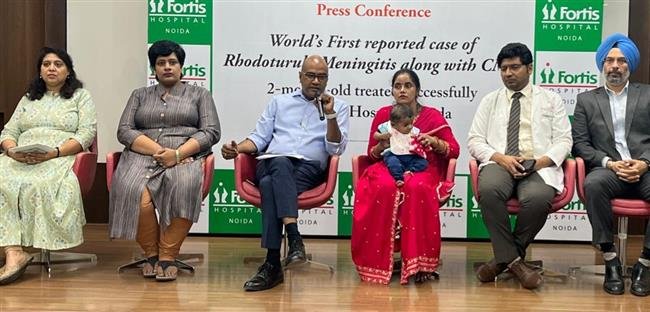 WORLD’S FIRST REPORTED CASE OF RHODOTURULA MENINGITIS ALONG WITH CMV MENINGITIS IN A 2-MONTH-OLD TREATED SUCCESSFULLY AT FORTIS NOIDA