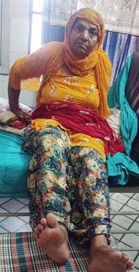 SRIGANGANAGAR DISTRICT HOSPITAL TEAM PERFORMS 600 BONE-JOINT REPLACEMENT SURGERIES